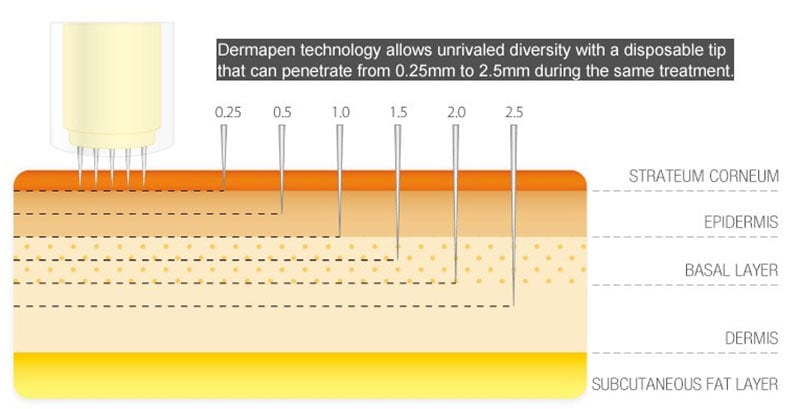 dermaroller pen treatment technology